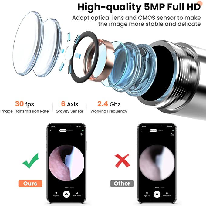 Ear Cleaning Camera Kit